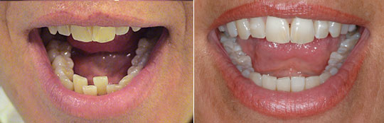estetica dental
