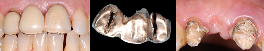estetica dental