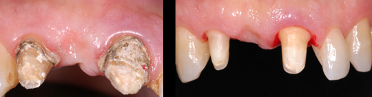 estetica dental