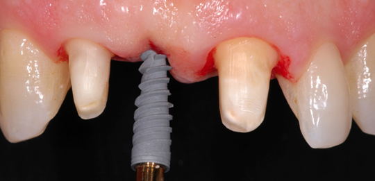 estetica dental