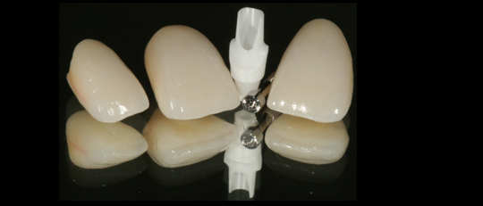 estetica dental