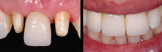 estetica dental