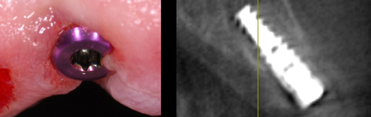 estetica dental
