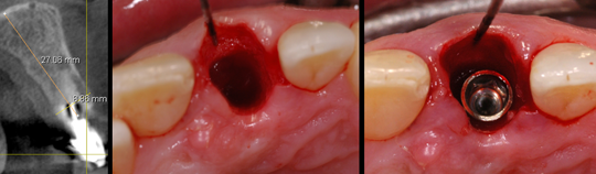 estetica dental