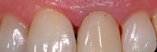 estetica dental