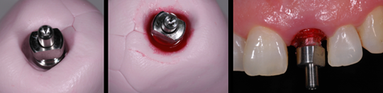 estetica dental