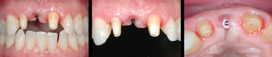 estetica dental