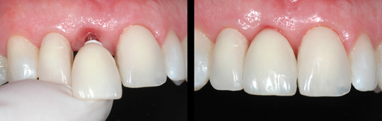 estetica dental