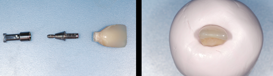 estetica dental