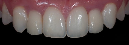 implantologia y estetica