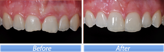 estetica dental