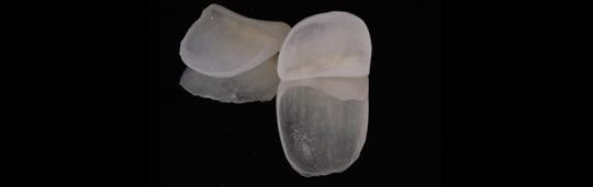 estetica dental