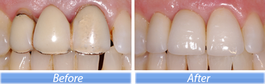 estetica dental
