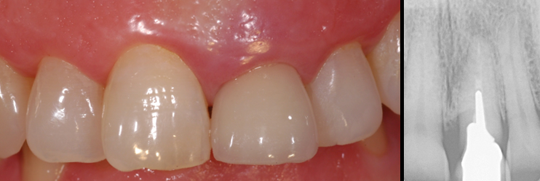 estetica dental