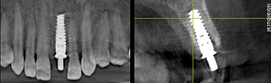 estetica dental